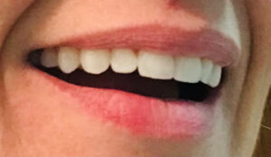 Dra. Patrícia Splendore | Dentista em Bragança Paulista | Ortodontia