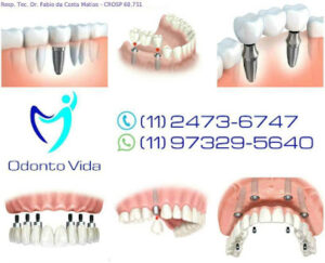 Odonto Vida Clínica Odontológica